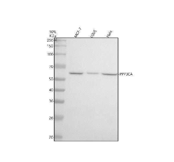 Western blot analysis of PPP3CA using anti-PPP3CA antibody (M03026)