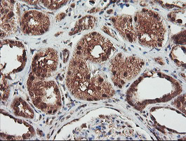 m03028 anti nln mouse monoclonal antibody clone id oti3h4 ihc testing 5