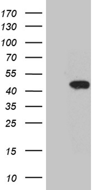 HEK293T cells were transfected with the pCMV6-ENTRY control (Left lane) or pCMV6-ENTRY GNAI1 (Right lane) cDNA for 48 hrs and lysed