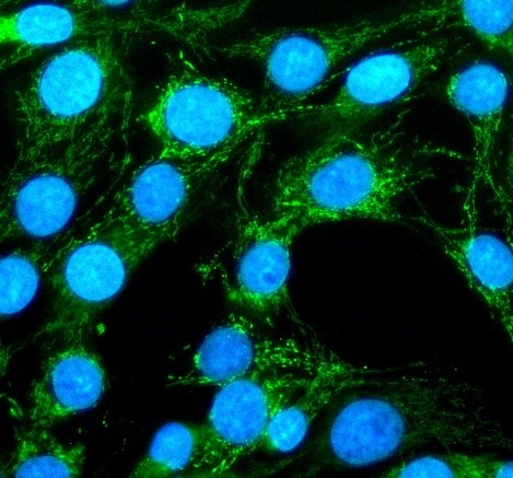 m03036 xct primary antibodies icc testing 1