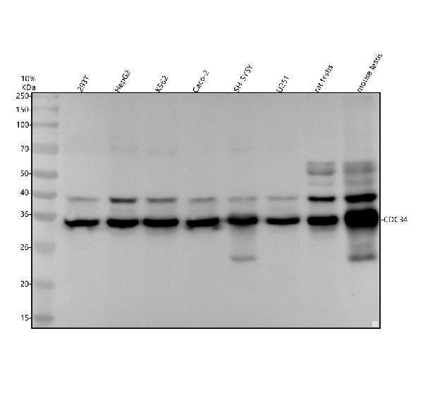 Western blot analysis of CDC34 using anti-CDC34 antibody (M03038)