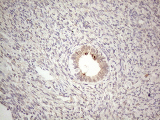 Immunohistochemical staining of paraffin-embedded Human endometrium tissue within the normal limits using anti-ABCC5 mouse monoclonal antibody