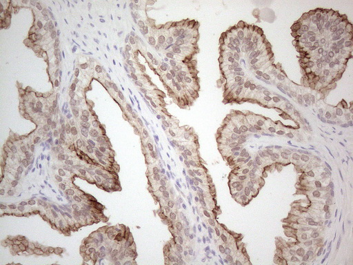 m03040 anti mrp5 abcc5 mouse monoclonal antibody clone id oti2c8 ihc testing 5
