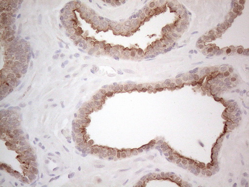 m03040 anti mrp5 abcc5 mouse monoclonal antibody clone id oti2c8 ihc testing 6