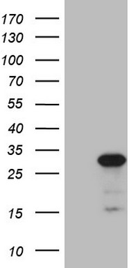 HEK293T cells were transfected with the pCMV6-ENTRY control (Left lane) or pCMV6-ENTRY ABCC5 (Right lane) cDNA for 48 hrs and lysed