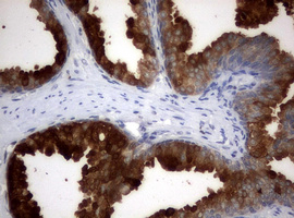 Immunohistochemical staining of paraffin-embedded Human prostate tissue within the normal limits using anti-MSMB mouse monoclonal antibody