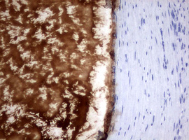 Immunohistochemical staining of paraffin-embedded Carcinoma of Human prostate tissue using anti-MSMB mouse monoclonal antibody
