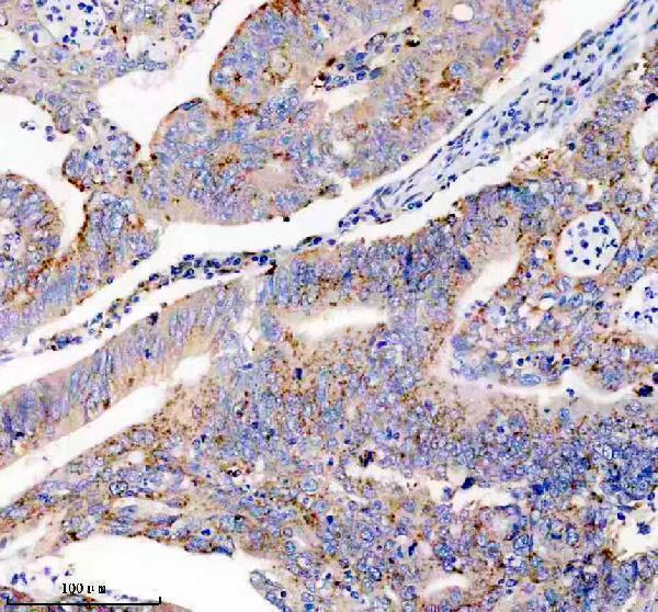 IHC analysis of USP14 using anti-USP14 antibody (M03042)