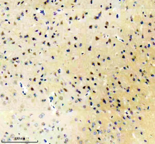 m03049 grm1 primary antibodies ihc testing 1_1