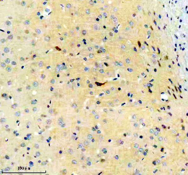 m03049 grm1 primary antibodies ihc testing 2_1