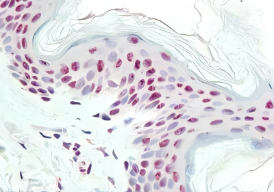 Immunohistochemistry of Mouse anti-IPO-38 antibody