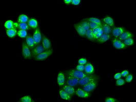 m03053 1 anti pim2 mouse monoclonal antibody clone id oti5d5 if testing 11