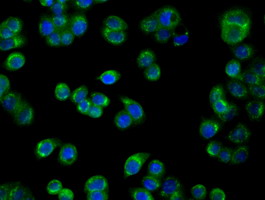 m03053 1 anti pim2 mouse monoclonal antibody clone id oti5d5 if testing 12