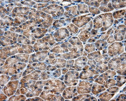m03053 1 anti pim2 mouse monoclonal antibody clone id oti5d5 ihc testing 4