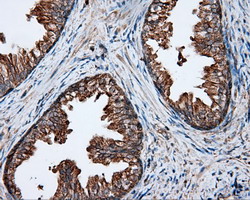 m03053 1 anti pim2 mouse monoclonal antibody clone id oti5d5 ihc testing 5