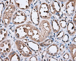 m03053 1 anti pim2 mouse monoclonal antibody clone id oti5d5 ihc testing 6