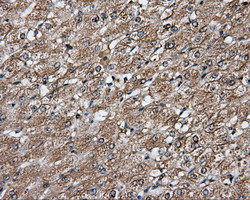 m03053 1 anti pim2 mouse monoclonal antibody clone id oti5d5 ihc testing 7