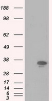 HEK293T cells were transfected with the pCMV6-ENTRY control (Left lane) or pCMV6-ENTRY PIM2 (Right lane) cDNA for 48 hrs and lysed
