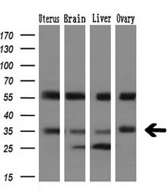 Western blot analysis of extracts (10ug) from 4 human tissue by using anti-PIM2 monoclonal antibody at 1:200 dilution