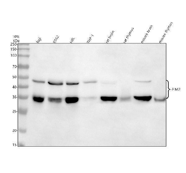  Western blot analysis of PIM2 using anti-PIM2 antibody (M03053-3)