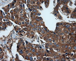m03053 anti pim2 mouse monoclonal antibody clone id oti8g10 ihc testing 10
