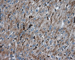 m03053 anti pim2 mouse monoclonal antibody clone id oti8g10 ihc testing 11