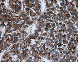 m03053 anti pim2 mouse monoclonal antibody clone id oti8g10 ihc testing 12