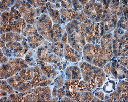 m03053 anti pim2 mouse monoclonal antibody clone id oti8g10 ihc testing 4
