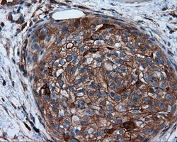 m03053 anti pim2 mouse monoclonal antibody clone id oti8g10 ihc testing 5