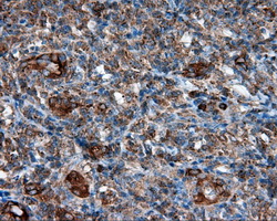 m03053 anti pim2 mouse monoclonal antibody clone id oti8g10 ihc testing 6