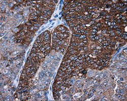 m03053 anti pim2 mouse monoclonal antibody clone id oti8g10 ihc testing 7