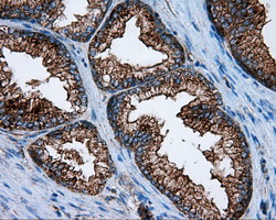 m03053 anti pim2 mouse monoclonal antibody clone id oti8g10 ihc testing 8