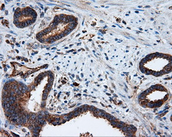 m03053 anti pim2 mouse monoclonal antibody clone id oti8g10 ihc testing 9