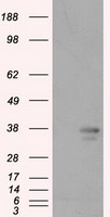 HEK293T cells were transfected with the pCMV6-ENTRY control (Left lane) or pCMV6-ENTRY PIM2 (Right lane) cDNA for 48 hrs and lysed