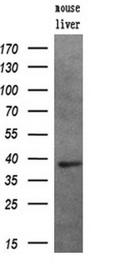 Western blot analysis of extracts (10ug) from a mouse tissue by using anti-PIM2 monoclonal antibody (1:200)