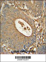 m03054 anti acox1 antibody ihc p testing 3