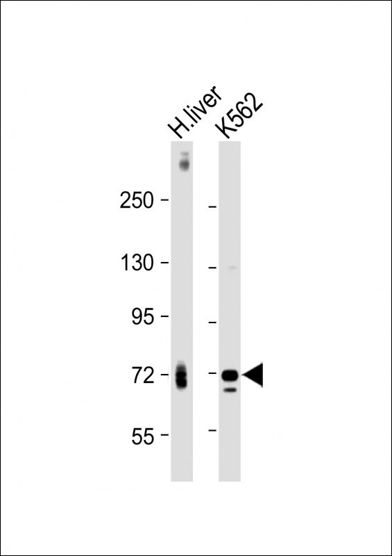 m03054 anti acox1 antibody wb testing 2