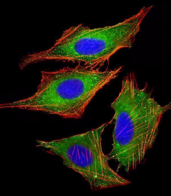m03058 anti ppp1r13l antibody n term if testing 1