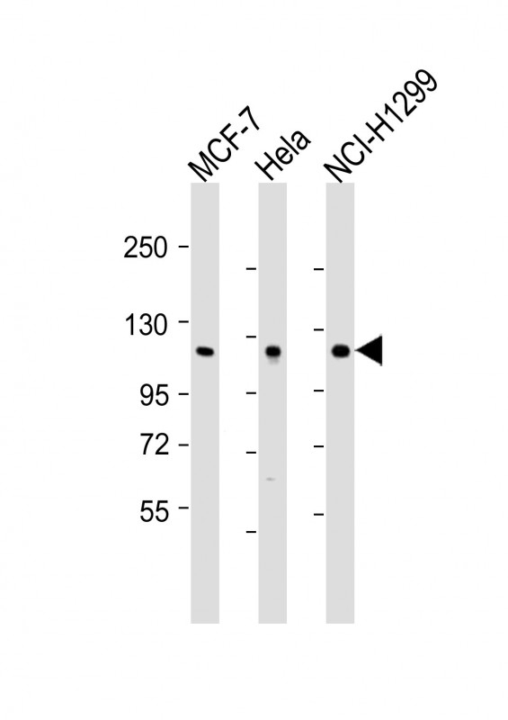 m03058 anti ppp1r13l antibody n term wb testing 2