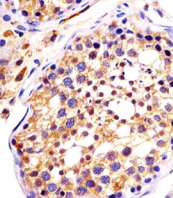 m03059 anti dync1h1 antibody c term ihc p testing 3