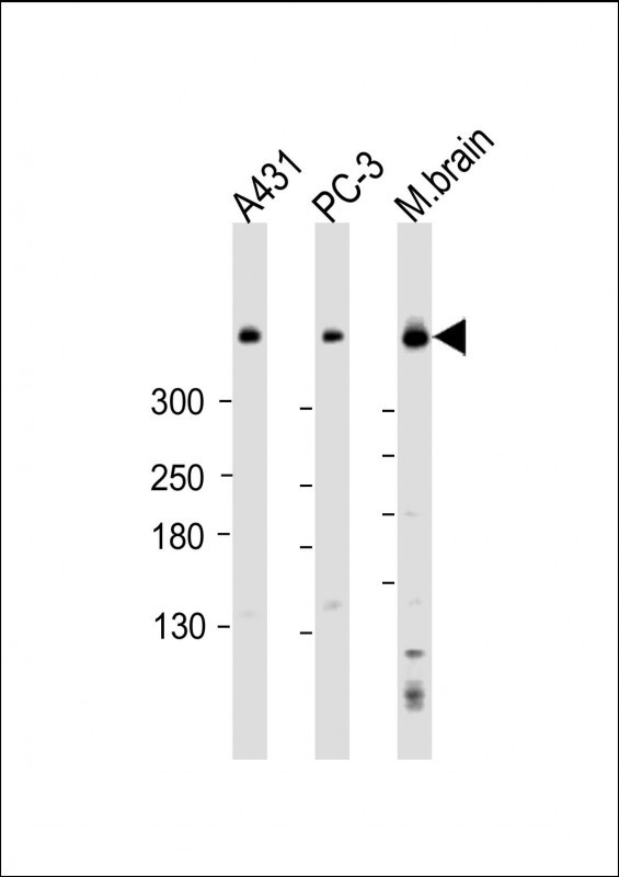 m03059 anti dync1h1 antibody c term wb testing 2
