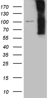 HEK293T cells were transfected with the pCMV6-ENTRY control (Left lane) or pCMV6-ENTRY NOS1AP (Right lane) cDNA for 48 hrs and lysed