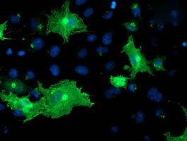 m03062 anti osbp1 osbp mouse monoclonal antibody clone id oti1f2 if testing 15