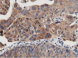 m03062 anti osbp1 osbp mouse monoclonal antibody clone id oti1f2 ihc testing 10