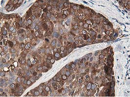 m03062 anti osbp1 osbp mouse monoclonal antibody clone id oti1f2 ihc testing 11