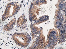 m03062 anti osbp1 osbp mouse monoclonal antibody clone id oti1f2 ihc testing 12