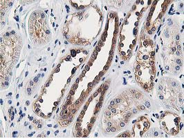 m03062 anti osbp1 osbp mouse monoclonal antibody clone id oti1f2 ihc testing 13