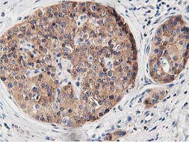 m03062 anti osbp1 osbp mouse monoclonal antibody clone id oti1f2 ihc testing 4