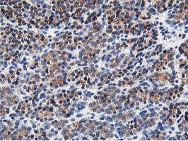 m03062 anti osbp1 osbp mouse monoclonal antibody clone id oti1f2 ihc testing 5