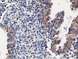 m03062 anti osbp1 osbp mouse monoclonal antibody clone id oti1f2 ihc testing 6
